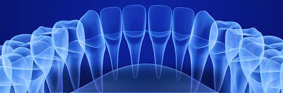 x-ray of teeth